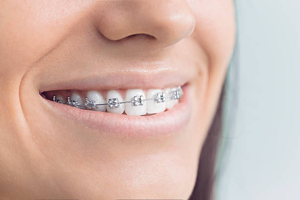 Best Veneers and Lumineers  in Roma, TX